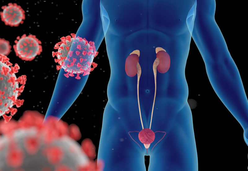 Digital-illustration-of-urinary-system-treated-by-TURBT