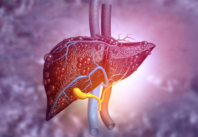 Illustration-of-diseased-liver-treated-by-cryoablation