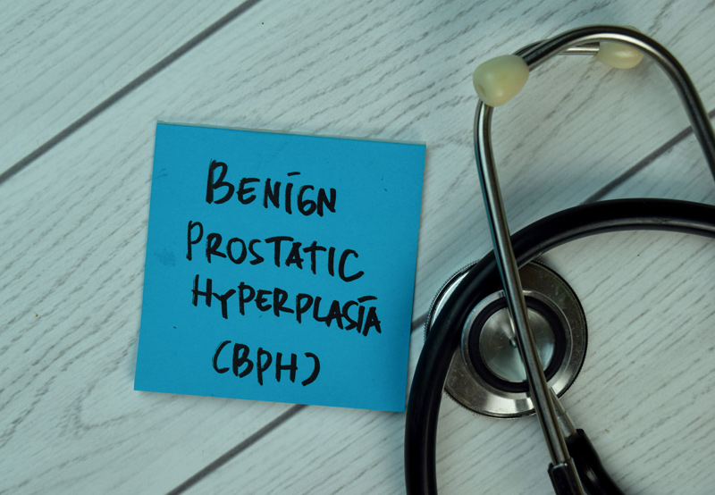 benign-prostatic-hyperplasia-written-on-a-note