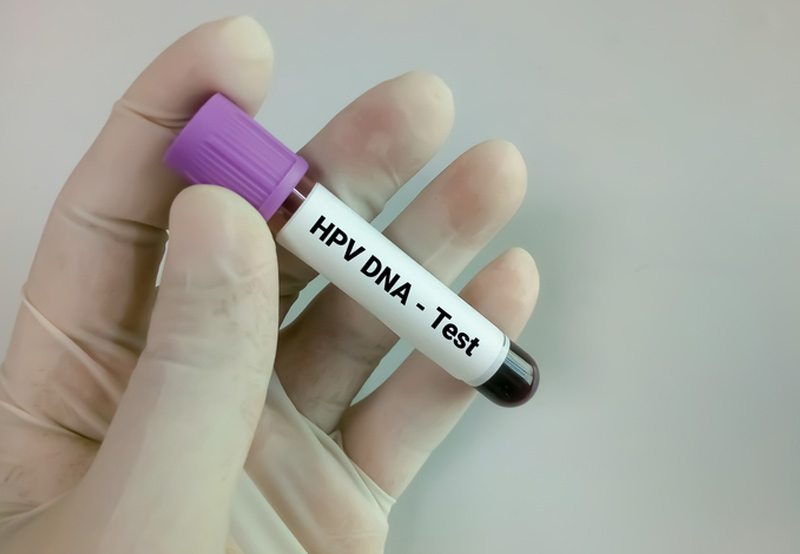 blood-test-for-HPV